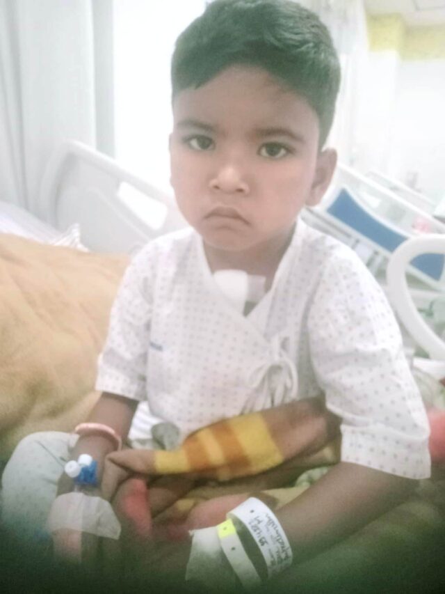 मुख्यमंत्री बाल हृदय उपचार योजना से आयुष के हृदय का हुआ सफल ऑपरेशन.